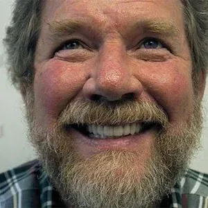 A man showing off his dental work from Dr. Bjorklund in Wayzata.