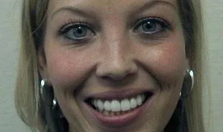 A woman smiling to show her dental work after treatment in Wayzata.